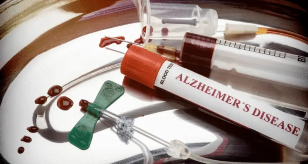Alt Attribute: Medical setup with a tube for an Alzheimer's blood test and equipment for drawing blood, highlighting advancements in memory decline prediction.