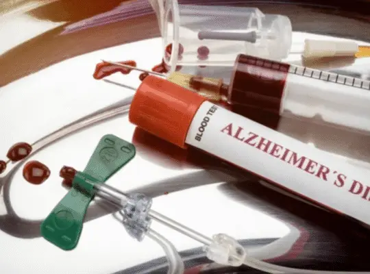 Alt Attribute: Medical setup with a tube for an Alzheimer's blood test and equipment for drawing blood, highlighting advancements in memory decline prediction.