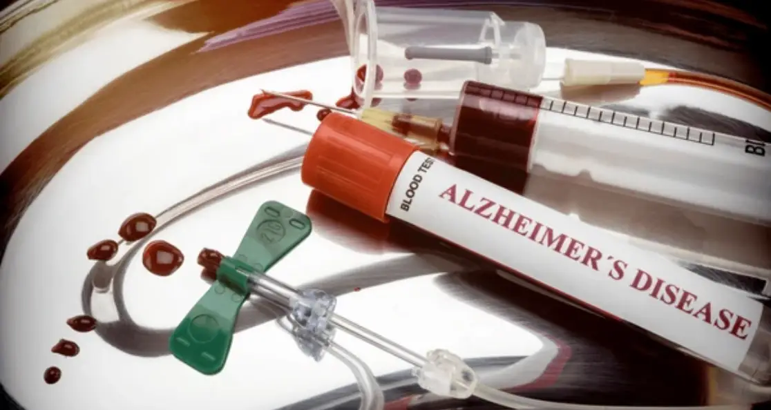 Alt Attribute: Medical setup with a tube for an Alzheimer's blood test and equipment for drawing blood, highlighting advancements in memory decline prediction.