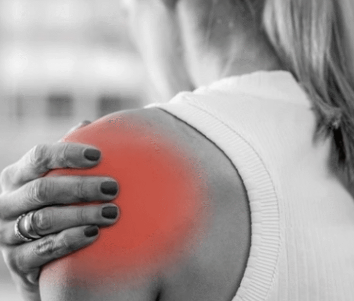 Woman experiencing shoulder pain holding inflamed area highlighted in red showing common joint injury and discomfort